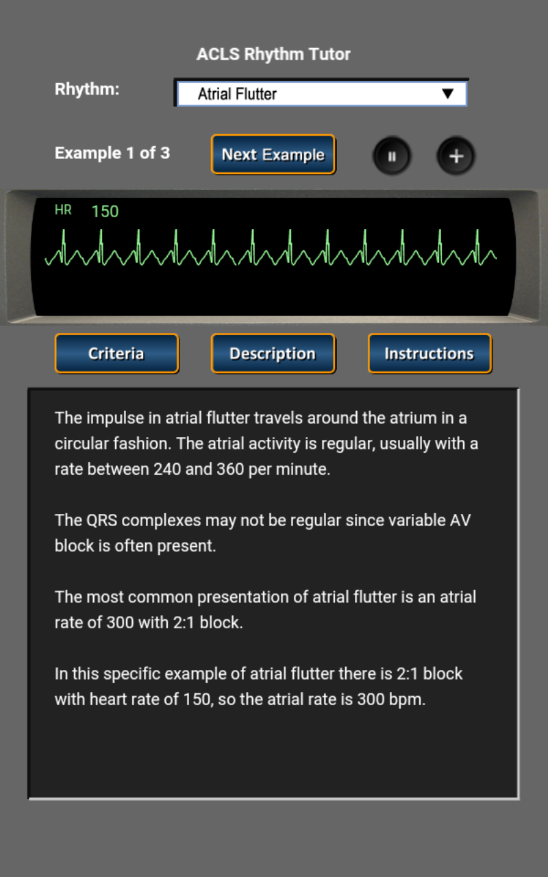 ECG and ACLS Mobile App – Anesoft Corporation