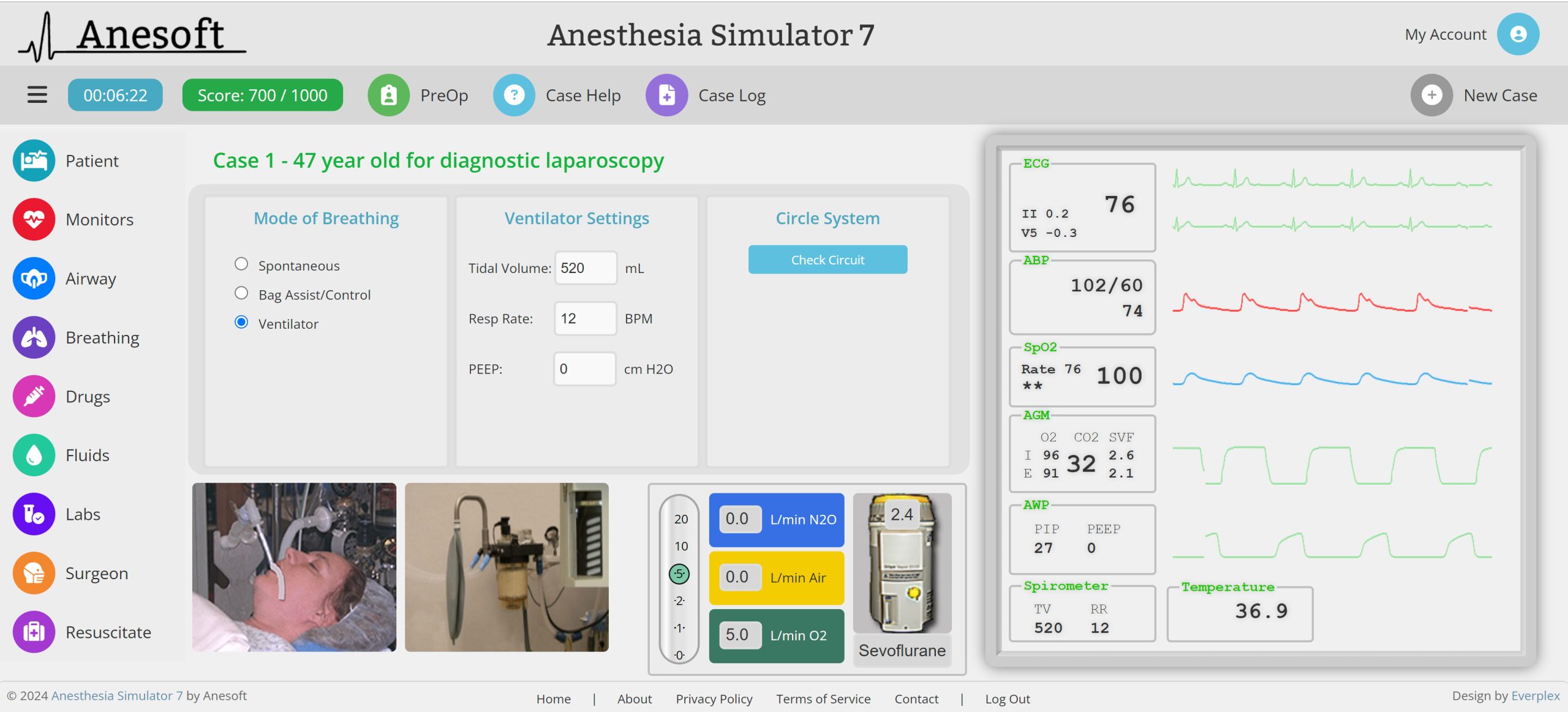 Anesthesia Simulator 7 Breathing