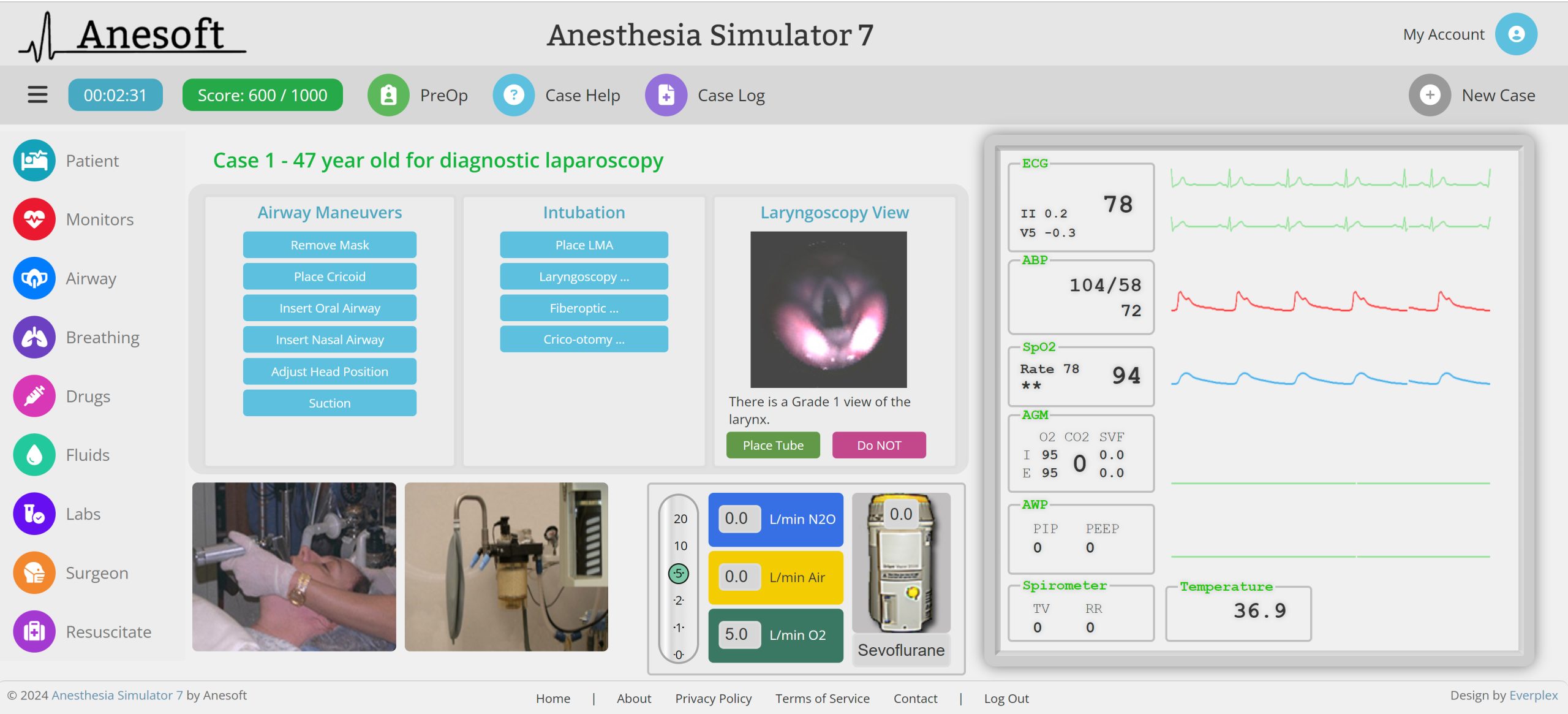 Anesthesia Simulator 7 intubation