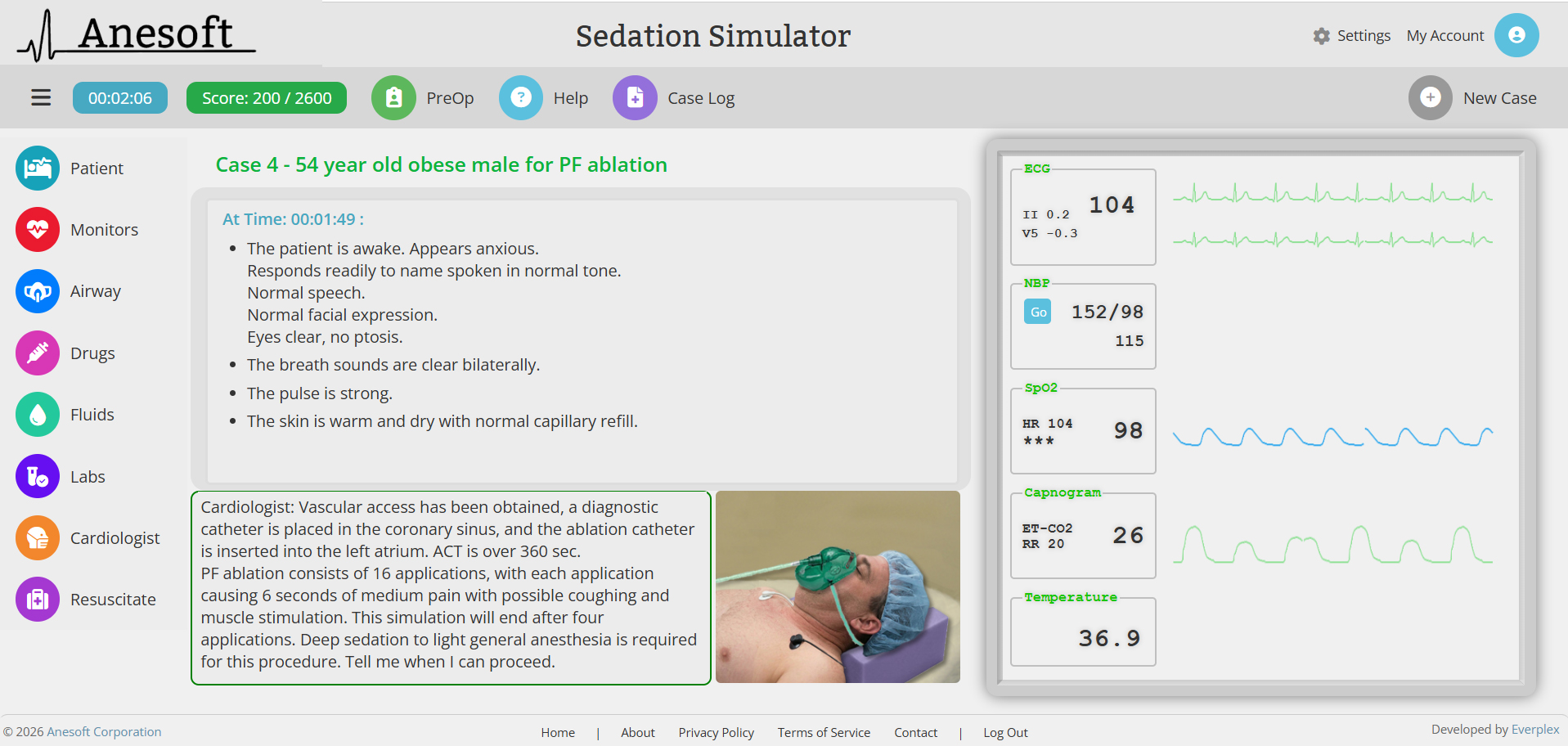 Sedation Simulator